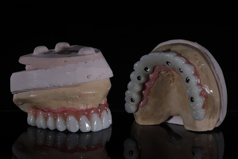 a full mouth set of dental implants arches showing the teeth and the holes for placement
