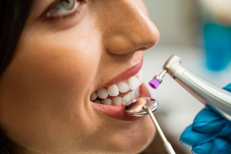 Teeth whitening Hudson