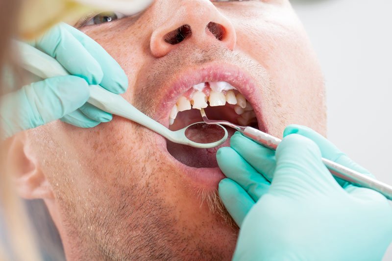 Oral surgeon Nashua