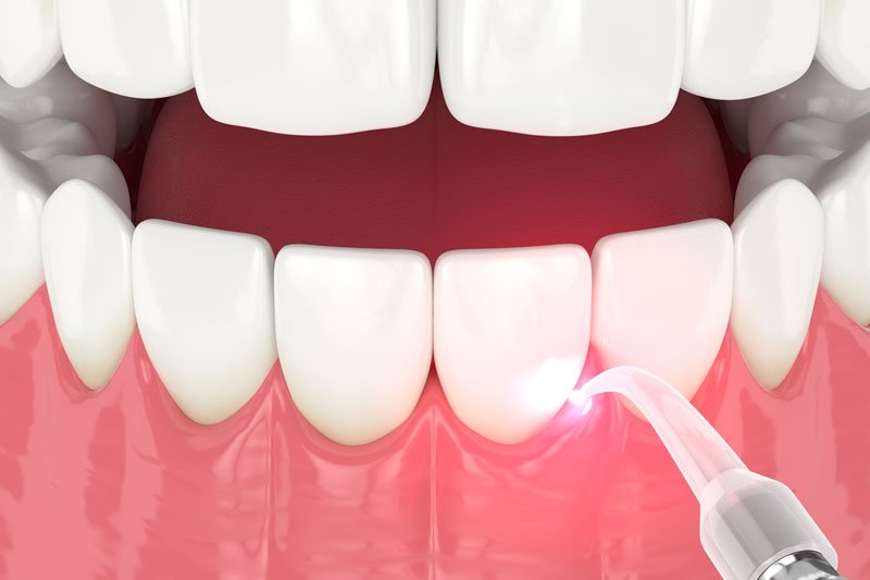 Pediatric dentist Burlington