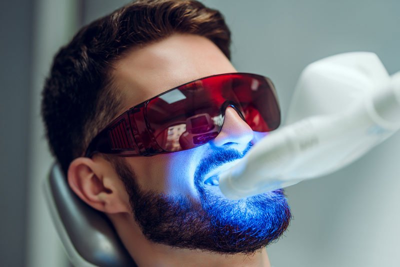 Teeth whitening patient with the blue light on his mouth and red glasses to reduce the brightness of the light