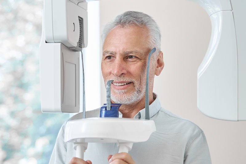 cbct scan to see any implant issues