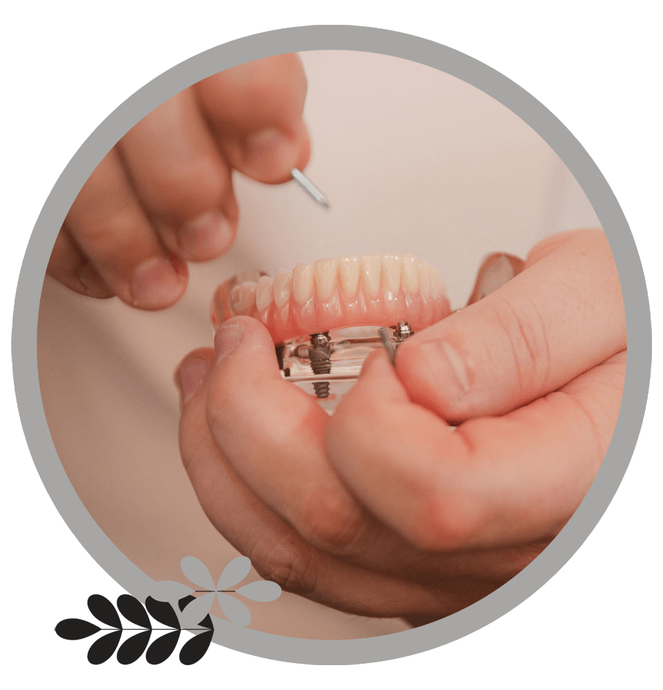 full mouth implants being examined