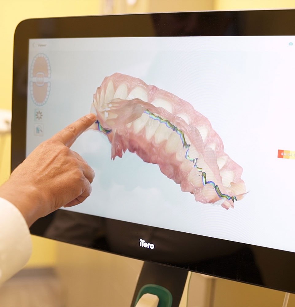 close up of display for dental procedure within the dental center