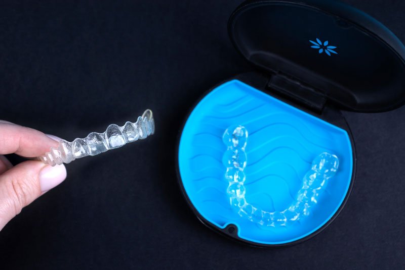 invisalign tray official being held