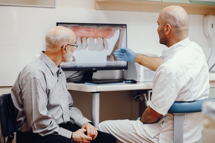 all on x dental implants
