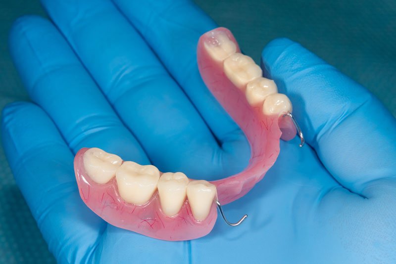 partial-denture