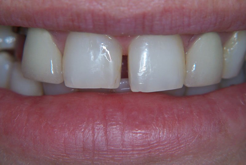 before dental treatment