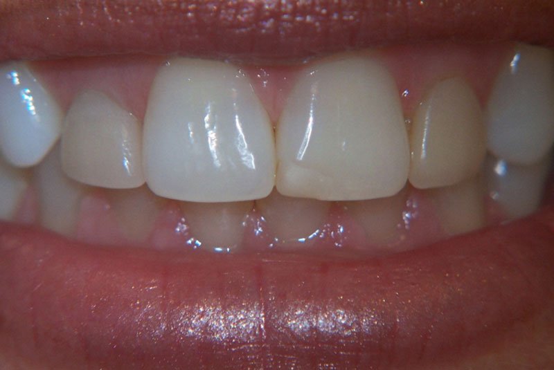 before dental treatment