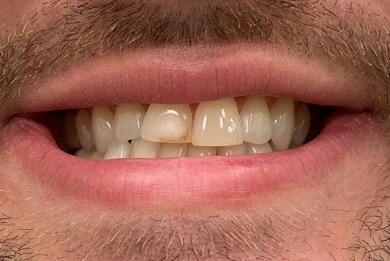 before dental treatment