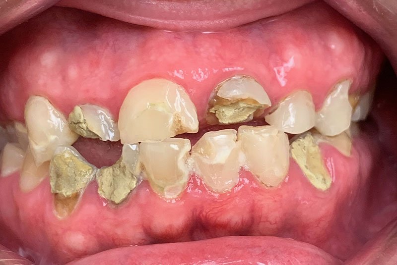 before dental treatment