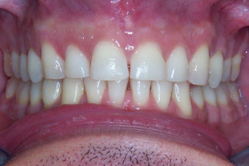 before dental treatment