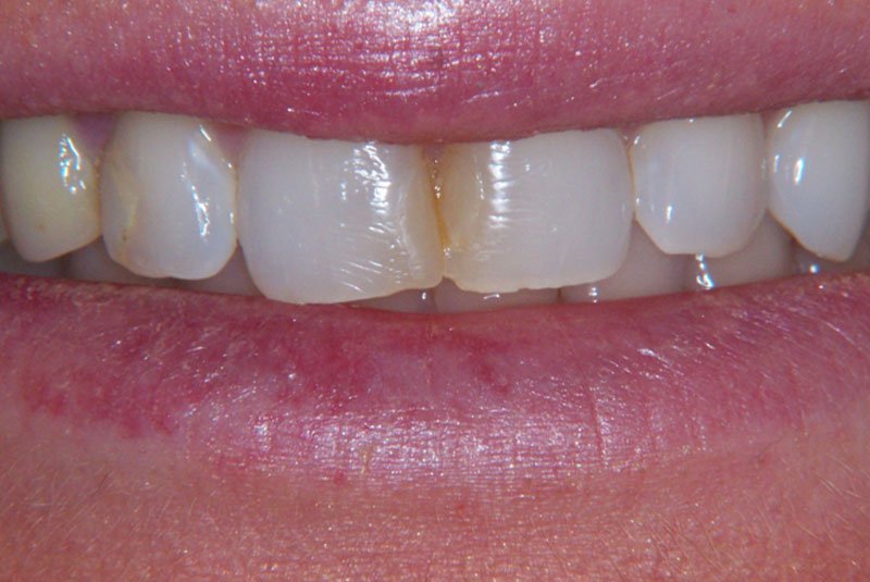 before dental treatment