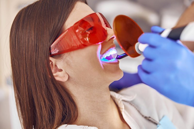 a teeth whitening procedure where the patient gets a light shone on their mouth
